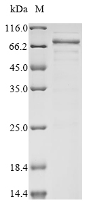 SDS-PAGE
