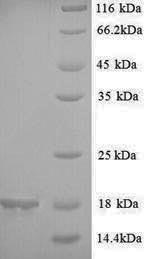 SDS-PAGE
