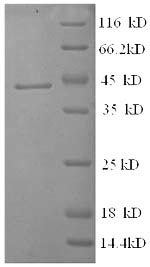 SDS-PAGE