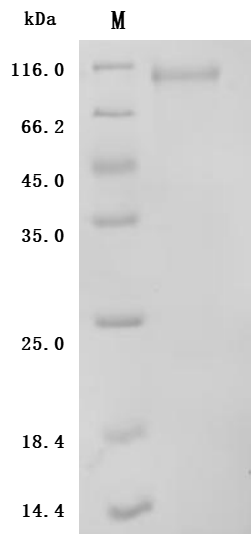 SDS-PAGE