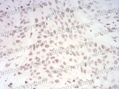 Валидация AntibodySystem RHF75403 (2652)
