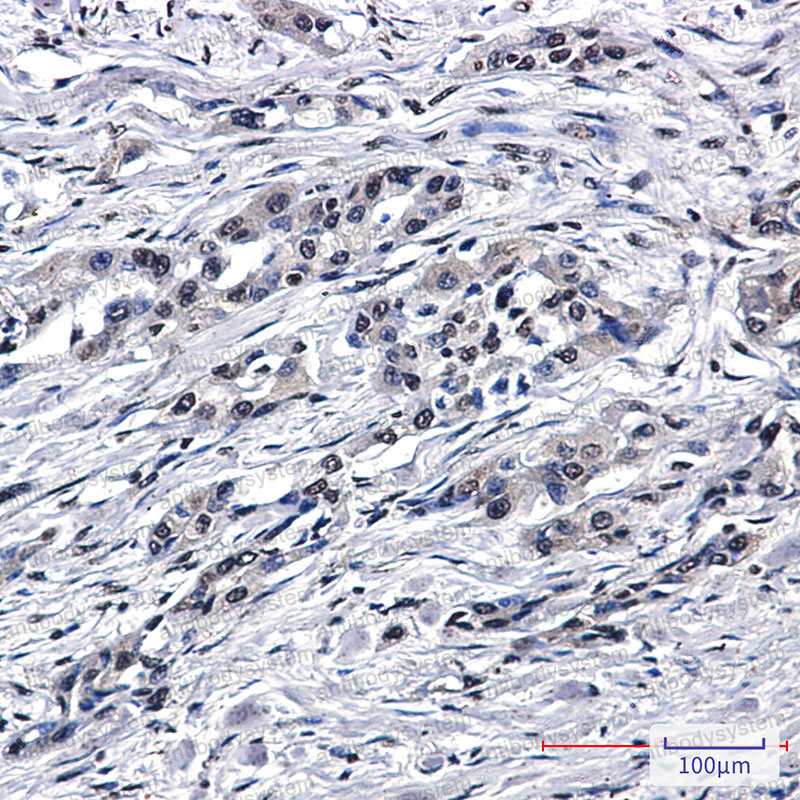 Валидация AntibodySystem RHN72801