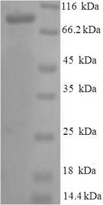 SDS-PAGE