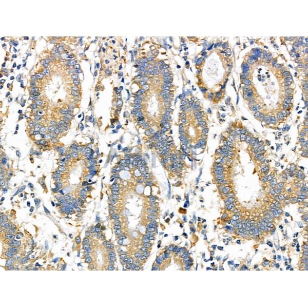 Валидация Affinity DF6236 - 17520