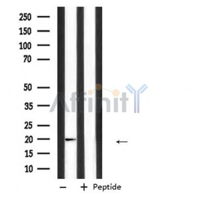Валидация Affinity DF6810 - 18381