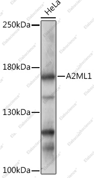 Вестерн-блоттинг, A2ML1, клетки HeLa