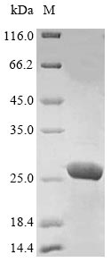SDS-PAGE