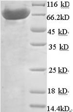 SDS-PAGE