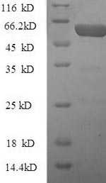 SDS-PAGE