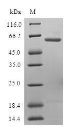 SDS-PAGE