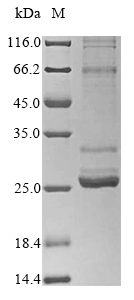SDS-PAGE