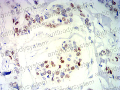 Валидация AntibodySystem RHC20004 (753)