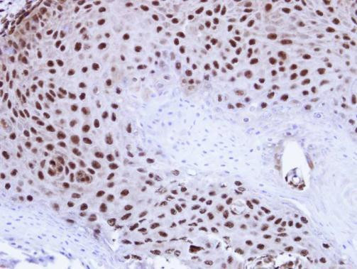 Валидация AssayVector ARM1491(1432)