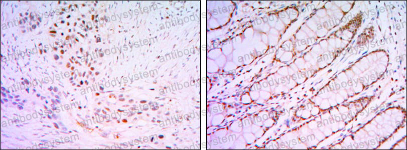 Валидация AntibodySystem RHA68101