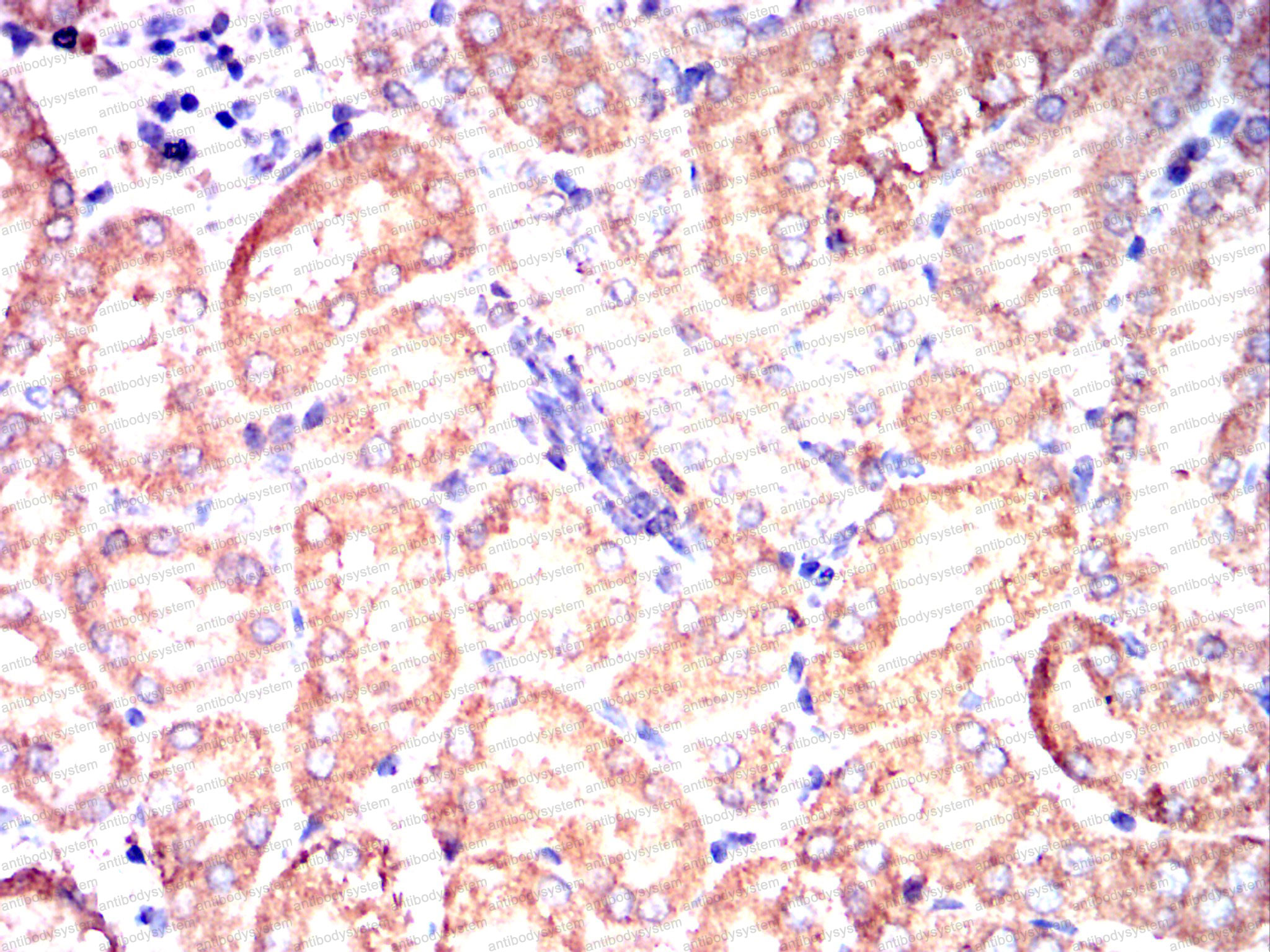 Валидация AntibodySystem RHC15806 (684)