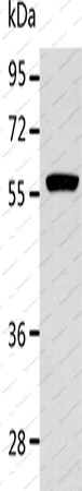 Вестерн-блоттинг, ALDH1A2, клетки K562