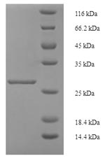SDS-PAGE