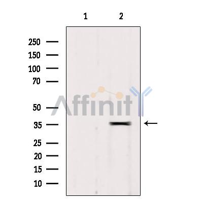 Валидация Affinity DF4657 - 16313