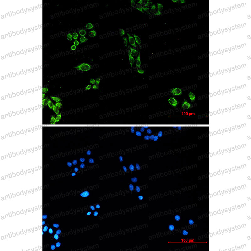Валидация IF - AntibodySystem RHF80805