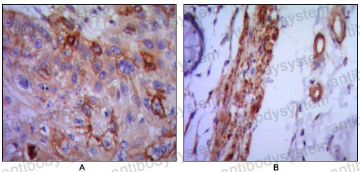 Валидация AntibodySystem RHD33104 (1495)
