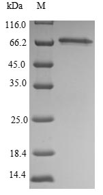 SDS-PAGE