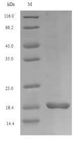 SDS-PAGE