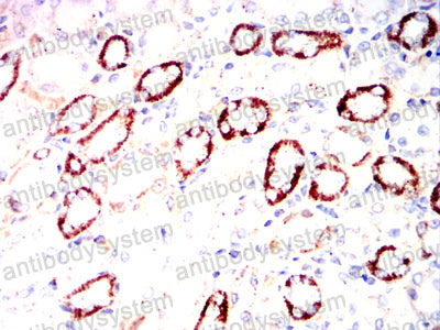 Валидация AntibodySystem RHG06501 (2821)