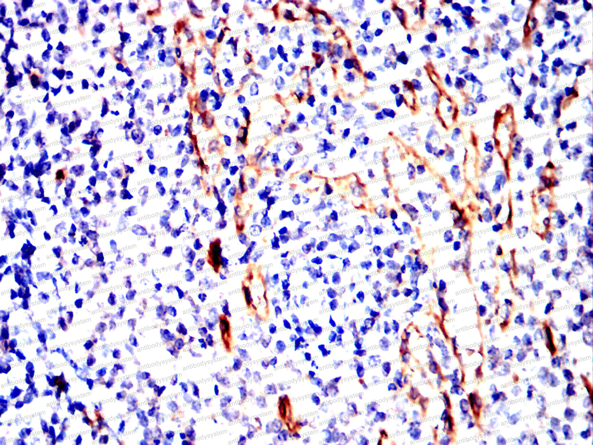 Валидация AntibodySystem RHD46601