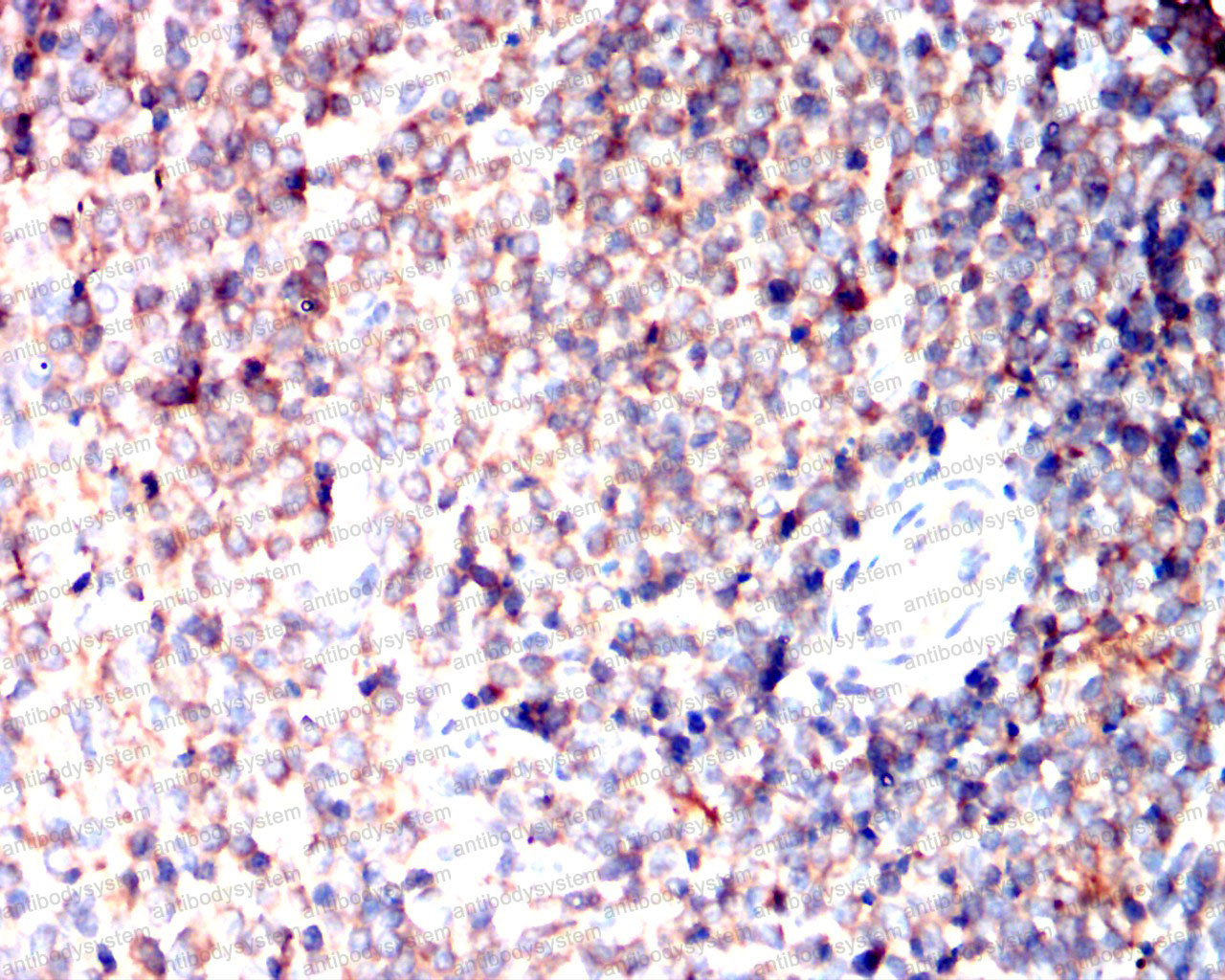 Валидация AntibodySystem RHE35201 (2103)