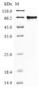 SDS-PAGE