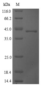SDS-PAGE
