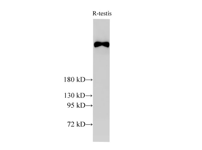 Вестерн-блоттинг, BRCA2, ткань семенника крысы