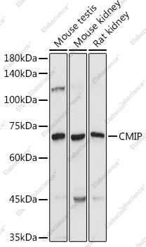Вестерн-блоттинг, CMIP, различные клеточные линии