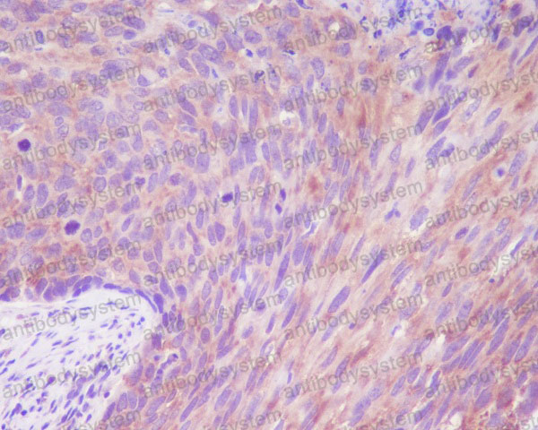 Валидация AntibodySystem RHF93802