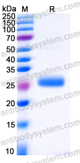 YHB91118, SDS-PAGE