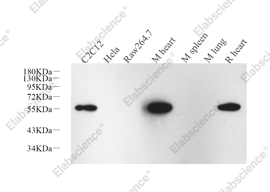 Вестерн-блоттинг, Desmin, различные образцы