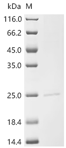 SDS-PAGE