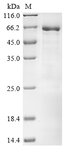 SDS-PAGE