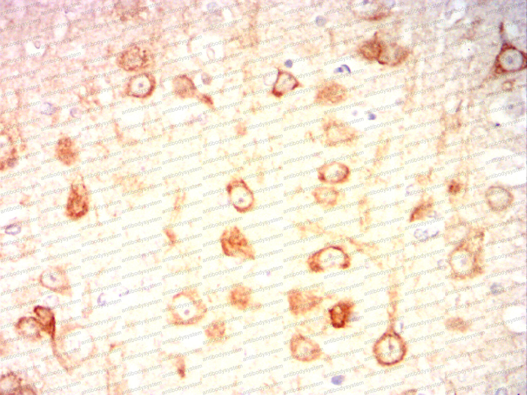 Валидация AntibodySystem RHG72104 (3068)