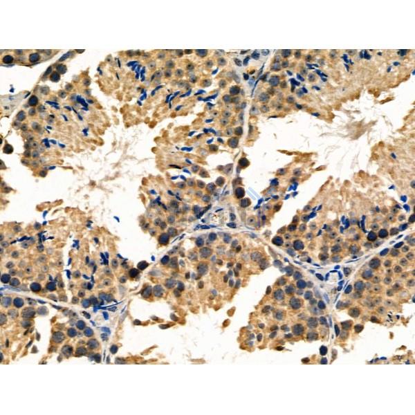 Валидация Affinity AF5238 - 2722