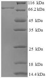 SDS-PAGE