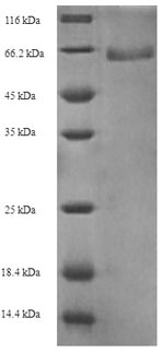 SDS-PAGE