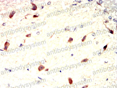 Валидация AntibodySystem RHD06804 (1308)