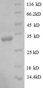SDS-PAGE