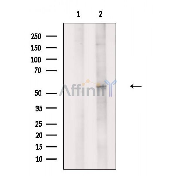 Валидация Affinity DF2510 - 13164