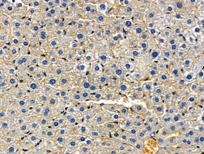 Валидация Affinity DF15504 - 11881