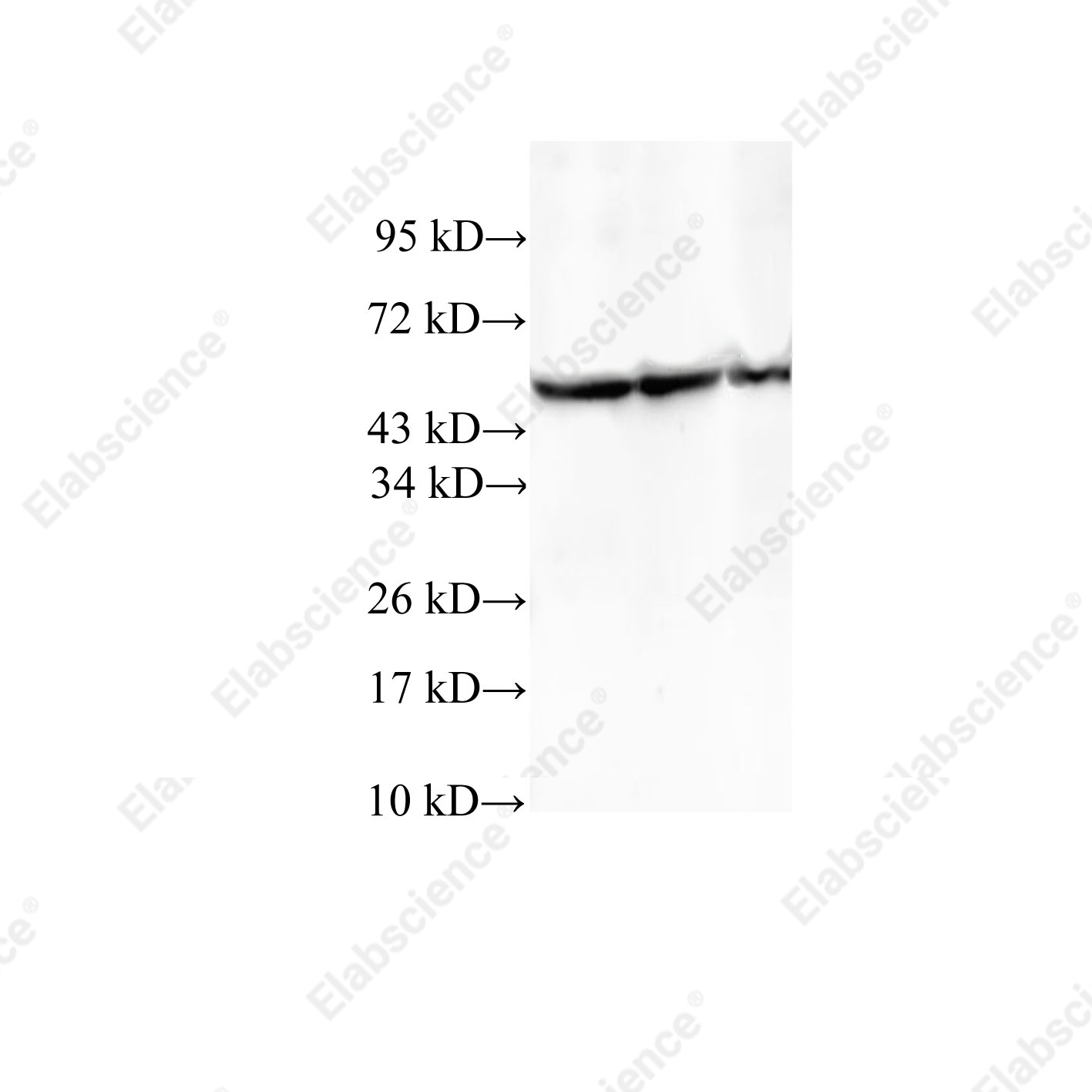 Вестерн-блоттинг, TCP1, клетки HeLa, A549 и 293T
