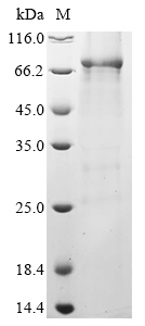 SDS-PAGE