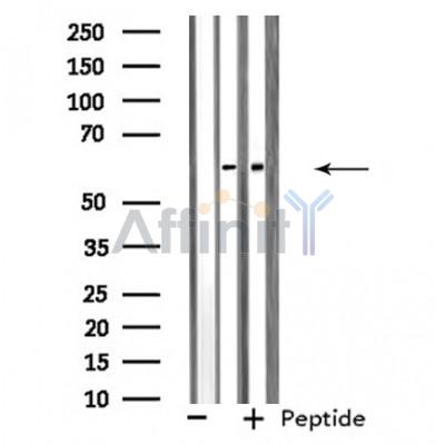 Валидация Affinity DF4536 - 16113