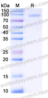 EHJ15002, SDS-PAGE